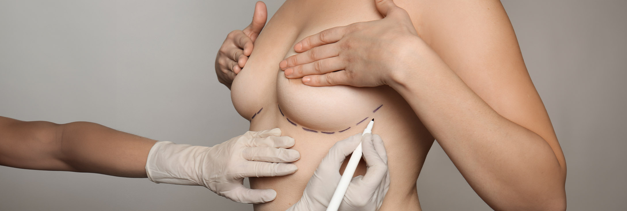 Photo of a consultation for a breast lift procedure