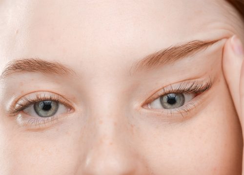 Photo of a woman pushing the skin around her eyelids