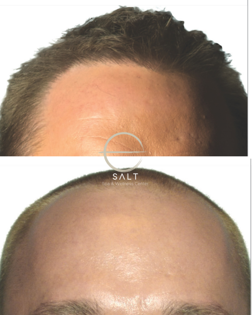hair restoration near me